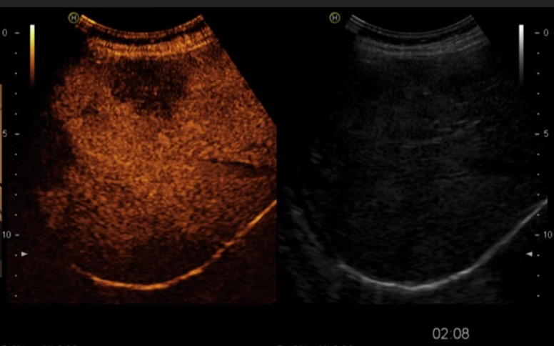 Режим эхоконтрастирования