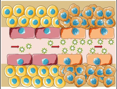 Эхоконтрастирование