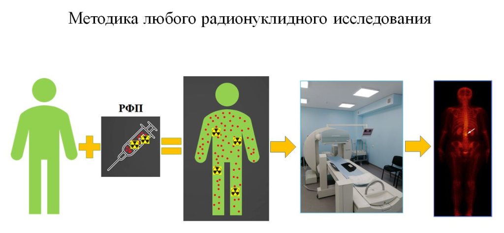 Методика любого радионуклидного исследования