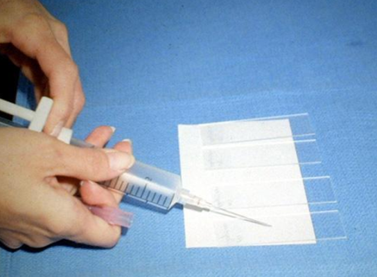 Процесс приготовления предметных стекол для цитологического исследования