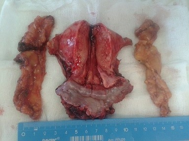 Макропрепарат