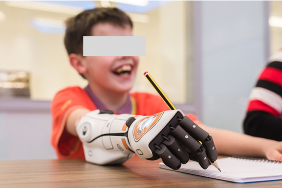 Рис.7 Экзопротез верхних конечностей Рис.7 Экзопротез верхних конечностей