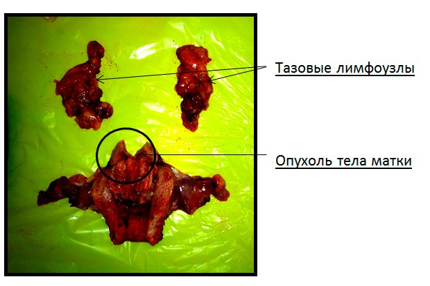 Прогноз заболевания