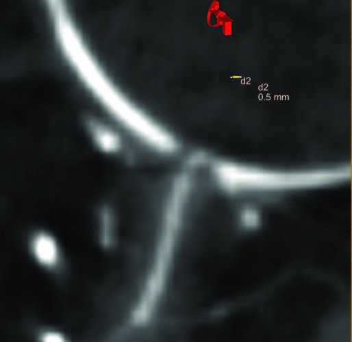 Пространственное разрешение