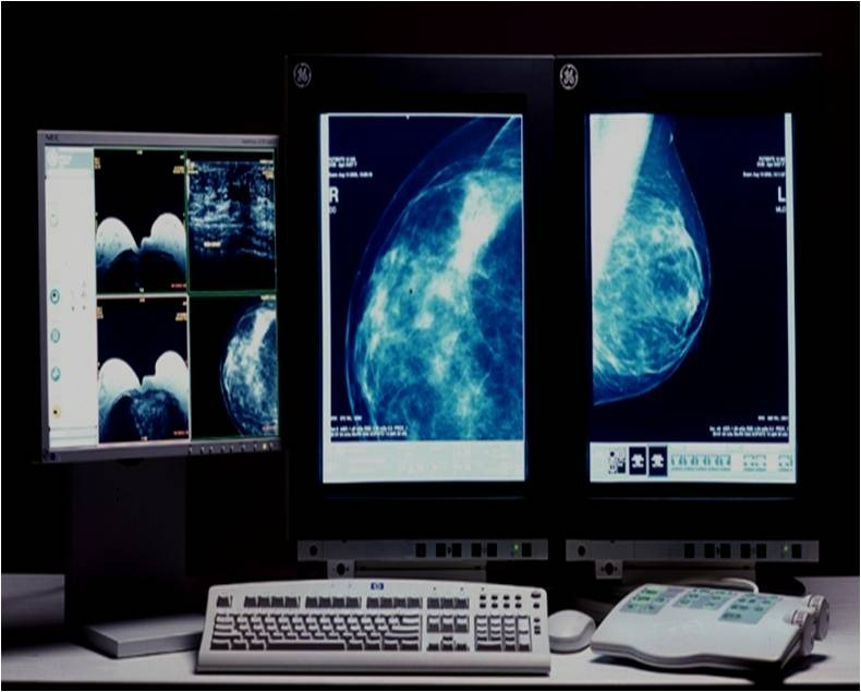 Рак молочной железы