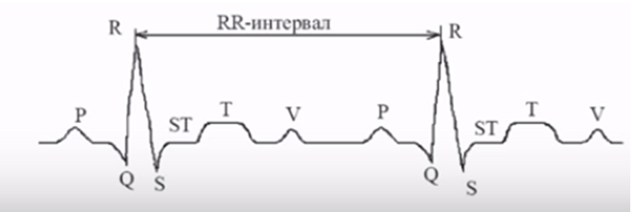 Правила измерения интервала QT
