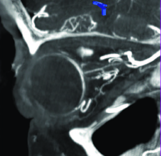 Пространственное разрешение