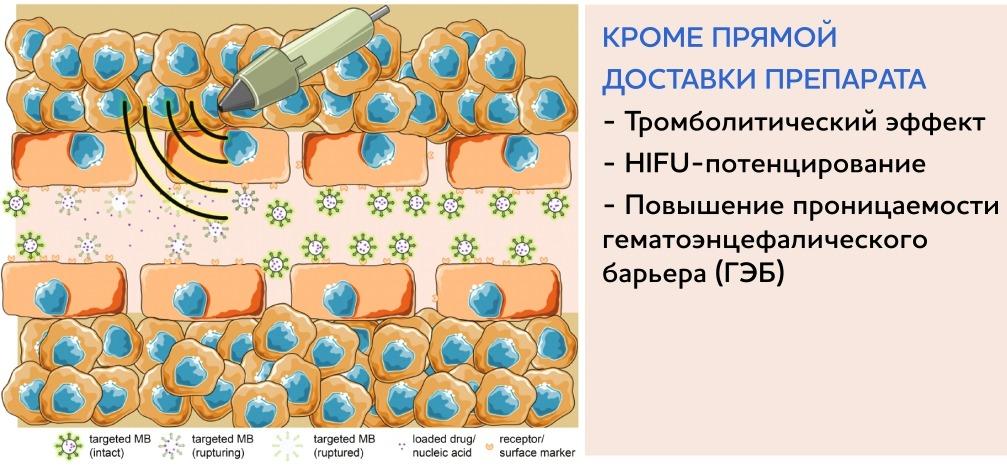 УЗИ с эхоконтрастированием