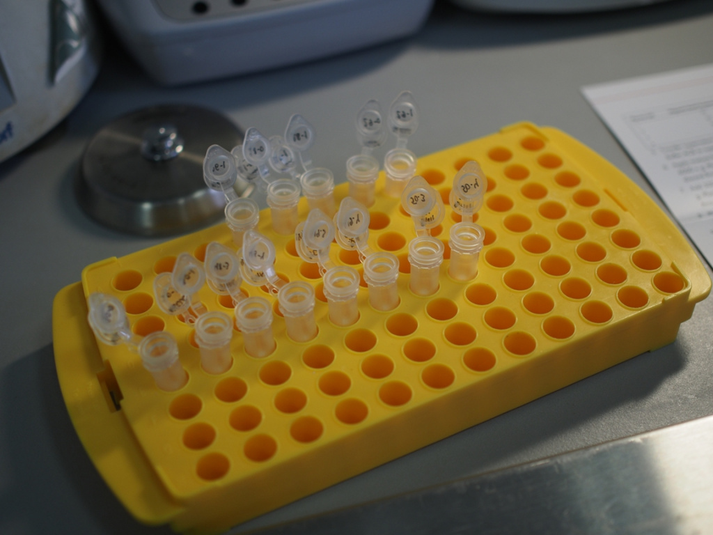 Определение мутации в генах KRAS и NRAS при раке толстой кишки